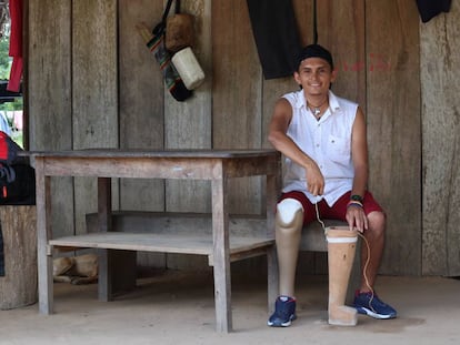 Diomedes Díaz sufrió un accidente con una mina antipersonal en el 2018. El CICR le donó una prótesis para reemplazar la pierna de madera que él mismo había tallado. 