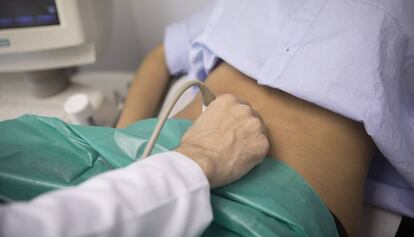 Realización de una ecografía de una mujer en el Hospital Vall d'Hebron (Barcelona).