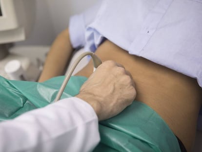 Realización de una ecografía de una mujer embarazada en el Hospital Vall d'Hebron (Barcelona). 