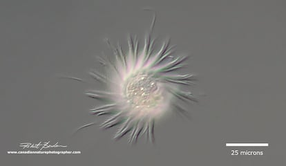 La 'Halteria sp', aquí vista al microscopio, es un protista ciliado (esos hilos como pestañas) que se mueve por espasmos al ritmo de 100 por segundo.