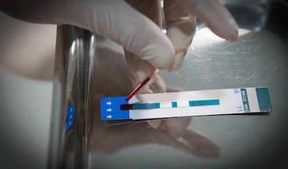Prueba rápida de VIH en Barcelona Check Point.