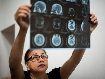 Josefa Esterlina Meza con una radiografía de su hijo, asesinado en las protestas de Nicaragua.