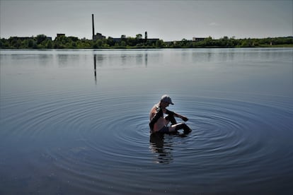 Viktor, de 71 años, se unta con barro para tratar de curar sus articulaciones.