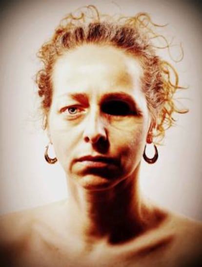 Fotografía del Facebook de Esther Quintana, colocada por ella misma en esa red social en la que se muestra sin el parche que habitualmente le cubre el ojo .Esther Quintana sufrió, presuntamente, el impacto de una pelota de goma en un ojo durante los disturbios registrados en Barcelona durante la huelga general del 14N.