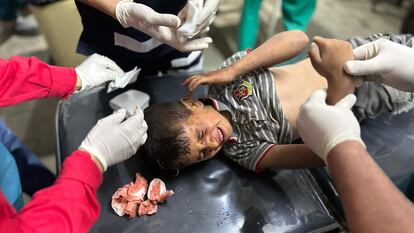 Un niño herido por un ataque israelí es tratado en un hospital de Rafah, este lunes. 