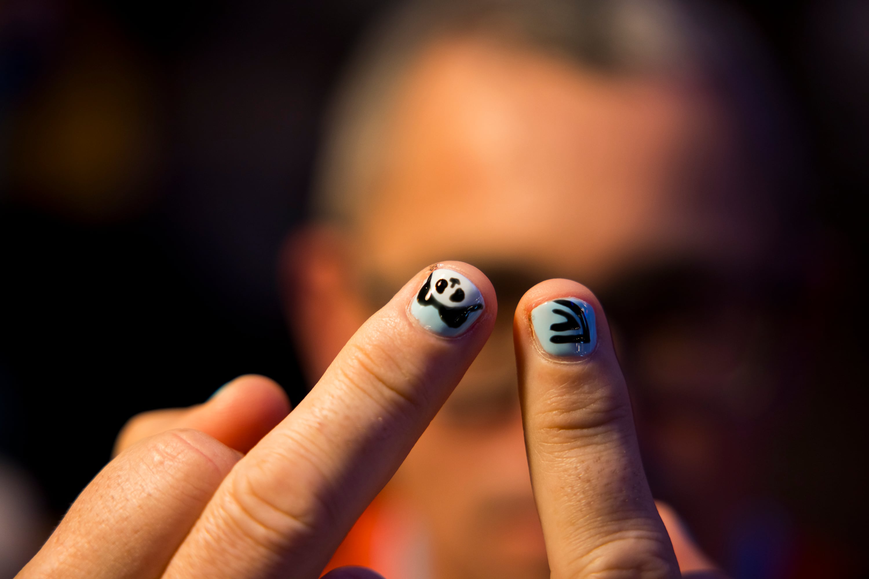 Distintas peñas han convocado a los seguidores del Real Club Celta de Vigo a pintarse las uñas en apoyo al jugador.