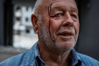 Volodímir, de 76 años, quien resultó herido en los recientes ataques rusos, permanece frente a uno de los edificios afectados.