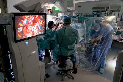 A screen shows the process of mapping the patient's brain to preserve the five languages she speaks as surgeons work to remove a cavernoma at the Hospital del Mar in Barcelona.