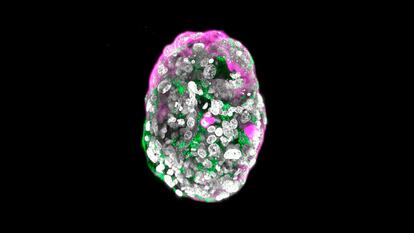 Modelo de embrión humano de 8 días, creado por el laboratorio del científico palestino Jacob Hanna, del Instituto Weizmann de Ciencias, en Rejovot (Israel).
