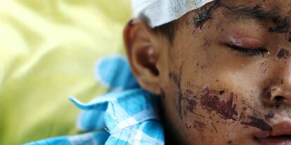Un niño herido por el terremoto y el tsunami, en un hospital en Palu (Indonesia).