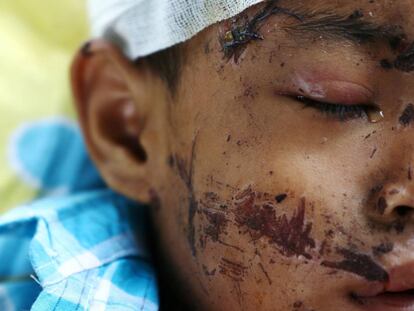 Un niño herido por el terremoto y el tsunami, en un hospital en Palu (Indonesia).