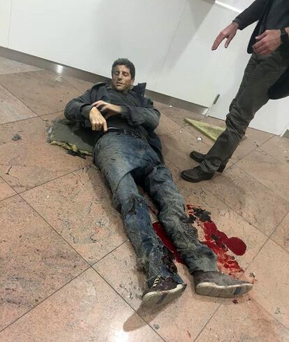 Imagen proporcionada por Radiodifusión Pública de Georgia, de Sébastian Bellin, ex baloncestista internacional belga, herido tras la explosión en el aeropuerto de Bruselas.
