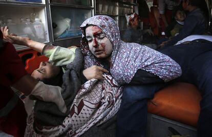 Una mujer herida en un bombardeo israelí llega a un hospital de Deir al Balah, este lunes. 