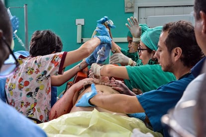 Uno de los supervivientes del avión Boeing-737 que se estrelló poco después de despegar del aeropuerto José Martí de La Habana (Cuba), es atendida en el hospital Calixto García de La Habana.