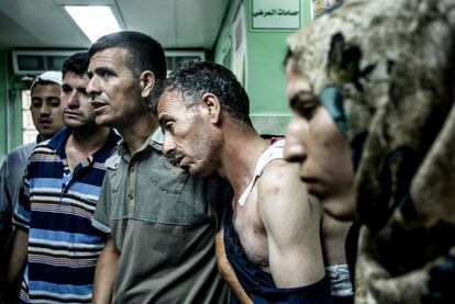 Civiles palestinos heridos en el bombardeo de la escuela de la ONU en el hospital de Beit Lahia, en el norte de Gaza.