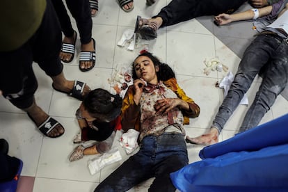 Varios heridos esperaban recibir atención médica en el hospital Al Shifa de la franja de Gaza. 