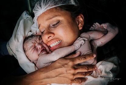 Esta foi a ganhadora como Melhor Imagem de Parto e se chama 'O maior amor do mundo' (Brasil).