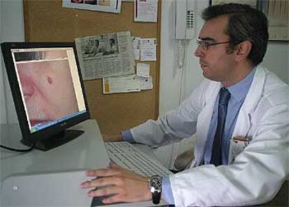 El dermatólogo David Moreno, del hospital Virgen Macarena de Sevilla, examina una fotografía.