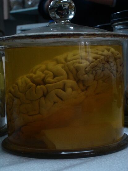 Cerebro de un cacique wichí y carta manuscrita de Lehmann-Nitsche guardadas en el Museo de Ciencias Naturales de La Plata, Buenos Aires.