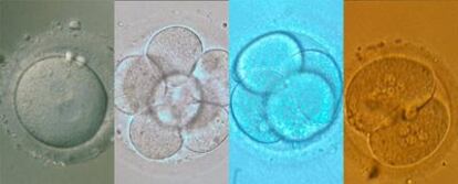 Embriones sanos de 20 horas, dos y tres días. El de la última foto, con varios núcleos por célula, no se transferiría.