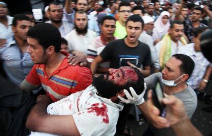 Seguidores de Morsi llevan a un hombre herido al hospital de campa&ntilde;a situado en la plaza de Rabea al Adauiya.
 