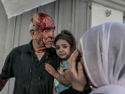 Palestinos afectados por un bombardeo israelí, este miércoles en Ciudad de Gaza.
