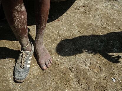 Un niño de la favela de Cidade de Deus calza un solo zapato. La reducción de la pobreza infantil es uno de los grandes retos de Brasil.