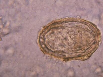 Huevos es &#039;Schistosoma haematobium&#039;.