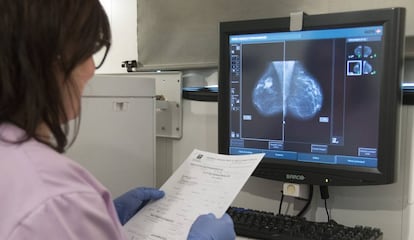 Una mamograf&iacute;a realizada a una mujer en la unidad m&oacute;vil de detecci&oacute;n precoz de c&aacute;ncer de mama en el Hospital Universitario Virgen del Roc&iacute;o (Sevilla).