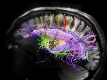 Imagen de una resonancia magnética del cerebro humano que muestra las curvas de fibras neuronales.