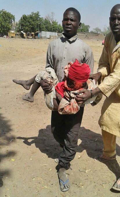 Fuentes de la Cruz Roja nigeriana aseguraron que entre los fallecidos figuran seis de sus trabajadores, mientras que otros trece resultaron heridos en el bombardeo. En la imagen, un hombre lleva en sus brazos a un niño herido en el ataque.