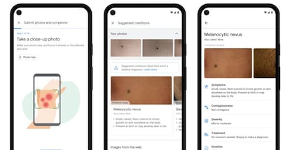 Aplicación para identificar problemas en la piel de Google.