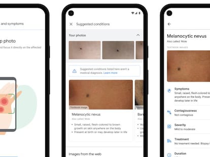 Aplicación para identificar problemas en la piel de Google.