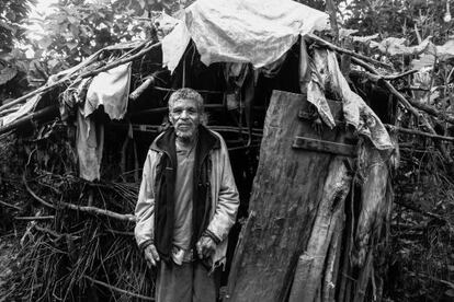 Hussien Dhekamo, enfermo de lepra, vive en una aldea en Gambo (Etiopía) construida de plásticos.