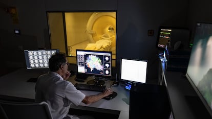 Un investigador revisa una resonancia magnética en la Fundación Pasqual Maragall, en Barcelona.