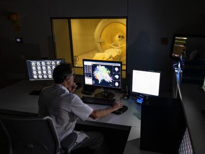 A researcher reviews an MRI at the Pasqual Maragall Foundation in Barcelona.