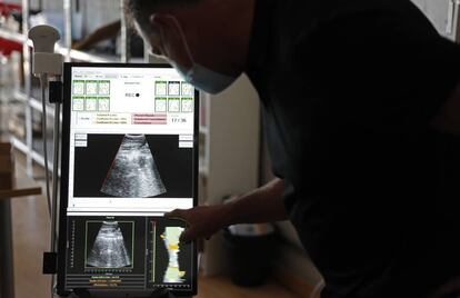 Prototipo del ecógrafo Ultracov, que gracias a la inteligencia artificial refleja con colores el grado de infección en el pulmón.