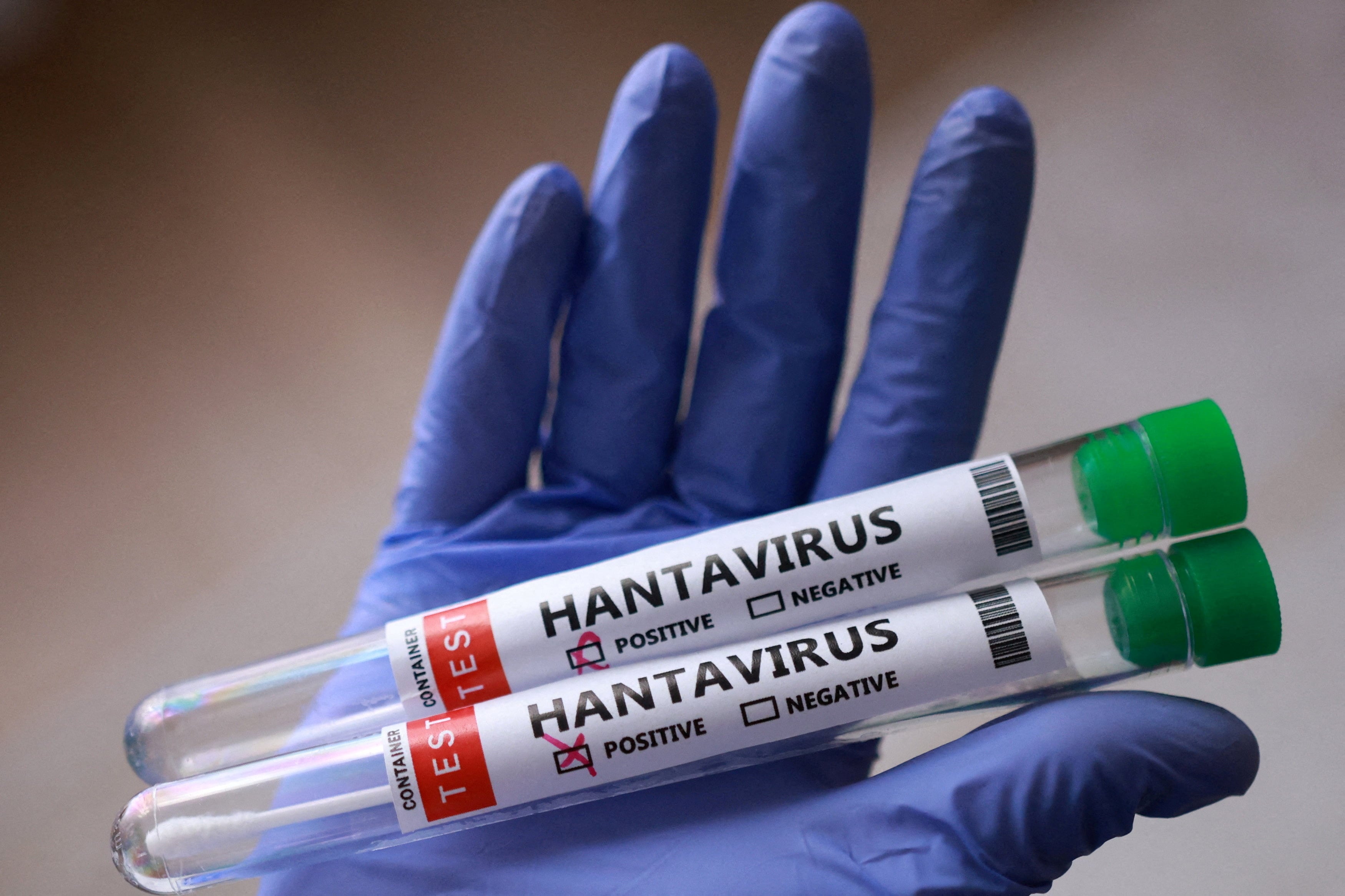 Rastreo de todos los afectados por el brote del hantavirus: ocho contagios, 30 desembarcados en Santa Elena y un contacto en Alicante