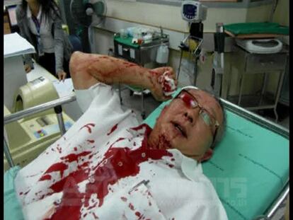 Tiroteado un líder de los camisas amarillas en Bangkok