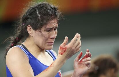 Janet Sovero (Per) limpia sangre de su cara durante el torneo contra Jackeline Renteria (Colombia). 