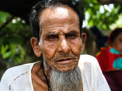 Abul, rohinyá de 76 años, llegó a Bangladesh hace dos décadas y media desde Birmania