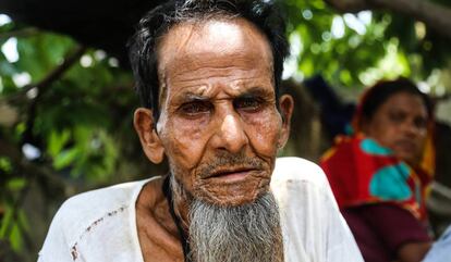 Abul, rohinyá de 76 años, llegó a Bangladesh hace dos décadas y media desde Birmania