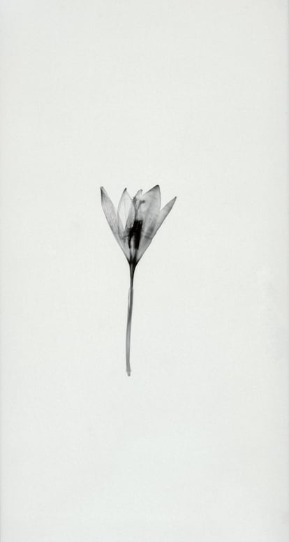 'Resistencias (V)'.