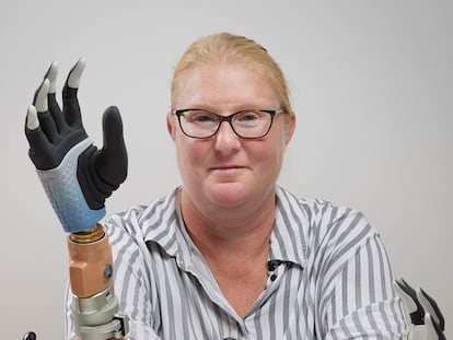 Tres años viviendo con una mano biónica: “Esta investigación me ha dado una vida mejor”