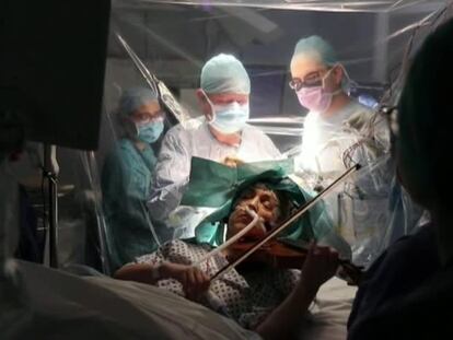 Dagmar Turner durante la operación. En vídeo, la mujer tocando para sus cirujanos.