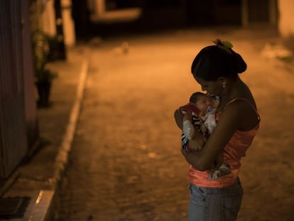 Mulher segura seu filho com Microcefalia, em Recife.
