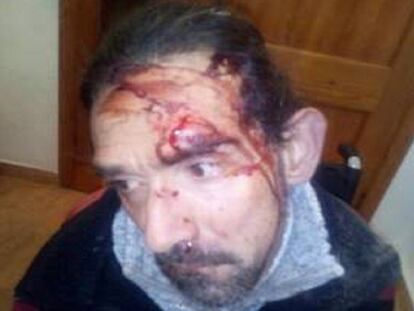 El hombre con parálisis cerebral agredido en Valencia en una imagen publicada por su hermano en Facebook.