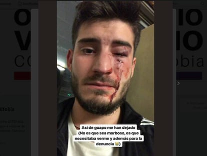 Foto que la víctima ha publicado en Twitter en la que muestra las lesiones causadas por la agresión.