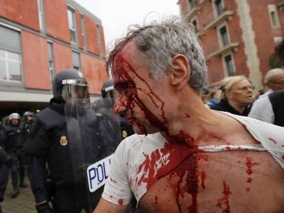 Herido tras la carga policial en la Barceloneta. En vídeo, así fue el 1-O.