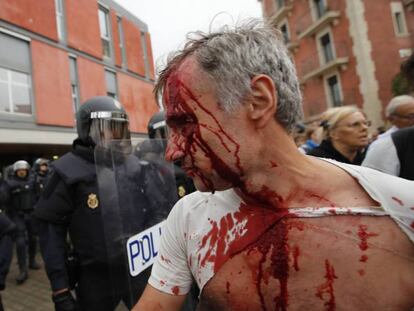 Ferit després de la càrrega policial a la Barceloneta. En vídeo, així va ser l'1-O.